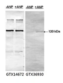 Anti-PDE5A (phospho Ser 92) antibody used in Western Blot (WB). GTX36930