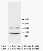 Anti-Phospholamban antibody used in Western Blot (WB). GTX37204