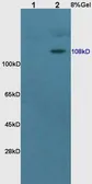 Anti-Mineralocorticoid Receptor antibody used in Western Blot (WB). GTX37373