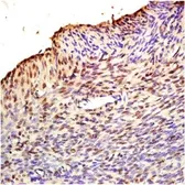Anti-FBXO32 antibody used in IHC (Paraffin sections) (IHC-P). GTX37381