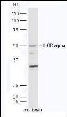 Anti-IL6 Receptor antibody used in Western Blot (WB). GTX37399