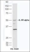 Anti-IL6 Receptor antibody used in Western Blot (WB). GTX37399