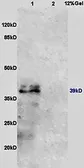 Anti-IL10 Receptor beta antibody used in Western Blot (WB). GTX37405