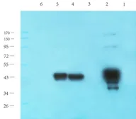 Anti-HOXA10 antibody used in Western Blot (WB). GTX37412