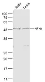 Anti-FOXJ1 antibody used in Western Blot (WB). GTX37424