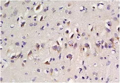 Anti-EAAT2 antibody used in IHC (Paraffin sections) (IHC-P). GTX37432