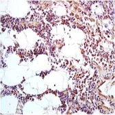 Anti-CLEC4A antibody used in IHC (Paraffin sections) (IHC-P). GTX37435