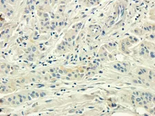 Anti-CD155 antibody used in IHC (Paraffin sections) (IHC-P). GTX37437