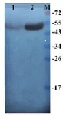 Anti-Cytokeratin 7 antibody used in Western Blot (WB). GTX37442