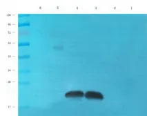 Anti-CD83 antibody used in Western Blot (WB). GTX37446