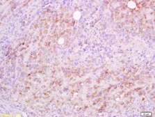 Anti-CD5L antibody used in IHC (Paraffin sections) (IHC-P). GTX37448