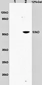 Anti-CD30 antibody used in Western Blot (WB). GTX37452