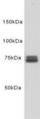 Anti-Transferrin antibody [N3H29L2] used in Western Blot (WB). GTX37474