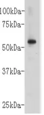 Anti-CD147 antibody used in Western Blot (WB). GTX37481