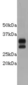 Anti-CD8 alpha antibody used in Western Blot (WB). GTX37508