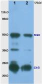Anti-Shh antibody used in Western Blot (WB). GTX37548