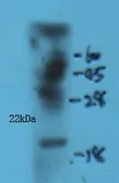 Anti-Shh antibody used in Western Blot (WB). GTX37548