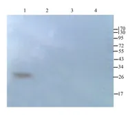 Anti-CD63 antibody used in Western Blot (WB). GTX37555