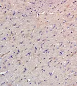 Anti-Osteopontin antibody used in IHC (Paraffin sections) (IHC-P). GTX37581