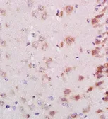 Anti-Neurocan antibody used in IHC (Paraffin sections) (IHC-P). GTX37603