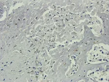 Anti-Nestin antibody used in IHC (Paraffin sections) (IHC-P). GTX37606