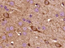 Anti-Kiss1 antibody used in IHC (Paraffin sections) (IHC-P). GTX37642