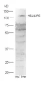 Anti-HSL antibody used in Western Blot (WB). GTX37663