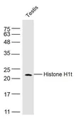 Anti-Histone H1t antibody used in Western Blot (WB). GTX37669