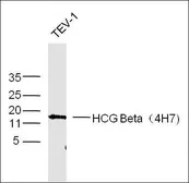 Anti-hCG beta antibody [4H7] used in Western Blot (WB). GTX37674