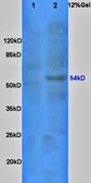 Anti-GLUT2 antibody used in Western Blot (WB). GTX37686