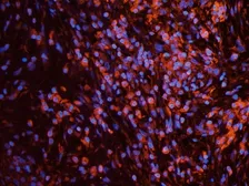 Anti-EPO receptor antibody used in IHC (Frozen sections) (IHC-Fr). GTX37704