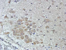 Anti-CTGF antibody used in IHC (Paraffin sections) (IHC-P). GTX37727
