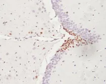 Anti-ATF3 antibody used in IHC (Paraffin sections) (IHC-P). GTX37776