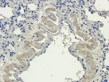 Anti-Aquaporin 4 antibody used in IHC (Paraffin sections) (IHC-P). GTX37784