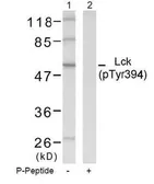 Anti-Lck (phospho Tyr394) antibody used in Western Blot (WB). GTX38561