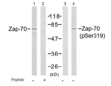 Anti-ZAP70 (phospho Tyr319) antibody used in Western Blot (WB). GTX38562