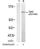 Anti-TYK2 (phospho Tyr1054) antibody used in Western Blot (WB). GTX38580