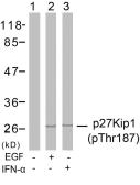 Anti-p27 Kip1 (phospho Thr187) antibody used in Western Blot (WB). GTX38594