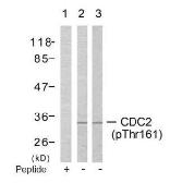 Anti-CDC2 (phospho Thr161) antibody used in Western Blot (WB). GTX38597