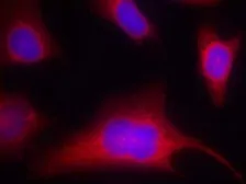Anti-PKC mu (phospho Ser910) antibody used in Immunocytochemistry/ Immunofluorescence (ICC/IF). GTX38601