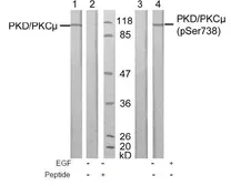 Anti-PKC mu (phospho Ser738) antibody used in Western Blot (WB). GTX38607