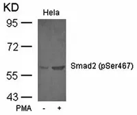 Anti-SMAD2 (phospho Ser467) antibody used in Western Blot (WB). GTX38629