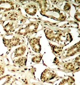 Anti-MEF2A (phospho Ser408) antibody used in IHC (Paraffin sections) (IHC-P). GTX38634