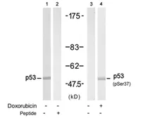 Anti-p53 (phospho Ser37) antibody used in Western Blot (WB). GTX38640