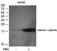 Anti-Stathmin 1 (phospho Ser25) antibody used in Western Blot (WB). GTX38657