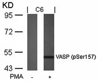 Anti-VASP (phospho Ser157) antibody used in Western Blot (WB). GTX38672