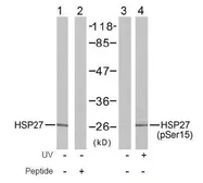 Anti-HSP27 (phospho Ser15) antibody used in Western Blot (WB). GTX38674