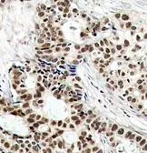 Anti-BRCA1 (phospho Ser1423) antibody used in IHC (Paraffin sections) (IHC-P). GTX38676