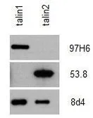 Anti-Talin-2 antibody [53.8] used in Western Blot (WB). GTX38971