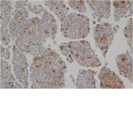Anti-SULF2 antibody [2B4], C-term used in IHC (Paraffin sections) (IHC-P). GTX38989